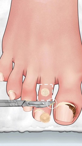 沉浸式修脚大师图3