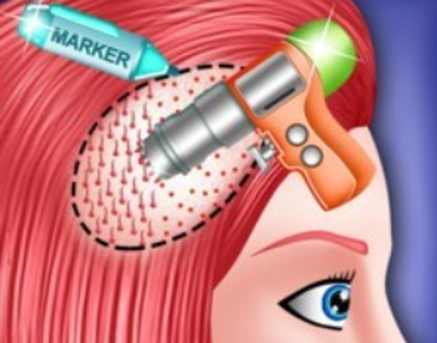 植发模拟器[图2]