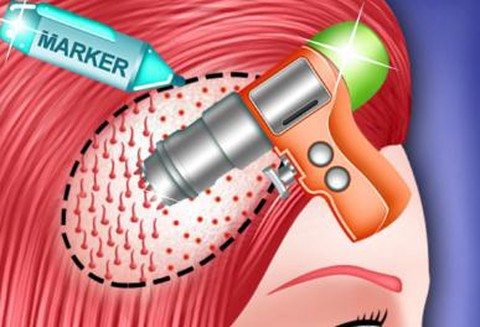 植发模拟器[图1]