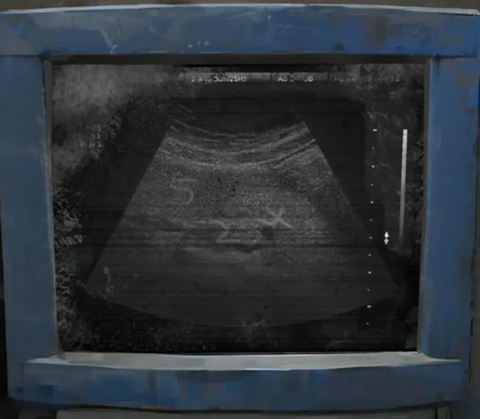 纸嫁衣8千子树[图3]