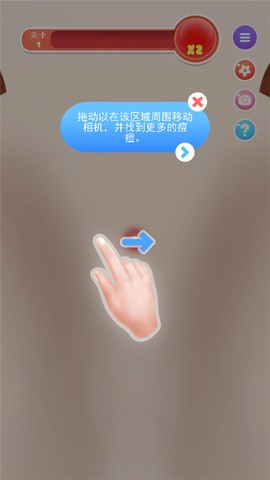 挤痘痘达人[图3]