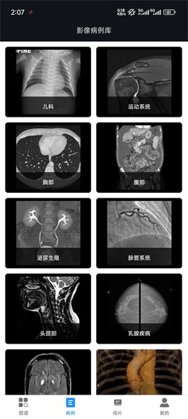 影像解剖图谱[图1]