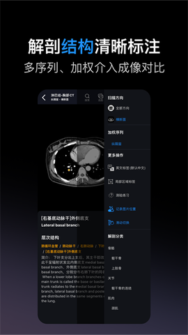 影像解剖图谱图1