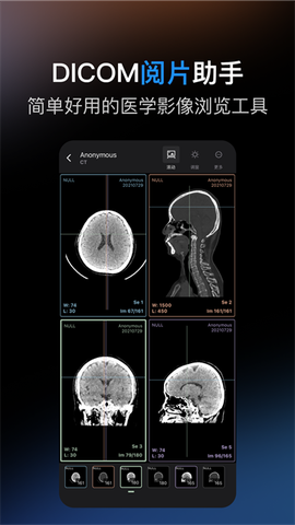 影像解剖图谱图2