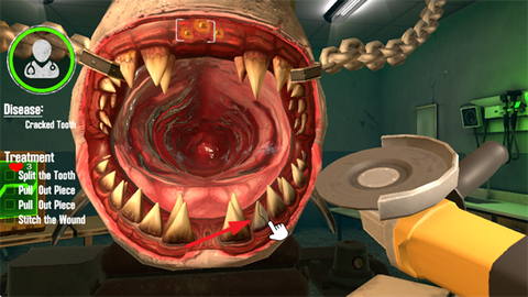 野兽牙医模拟器[图2]