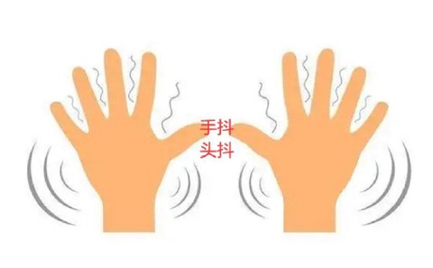 玩第五人格手抖怎么办