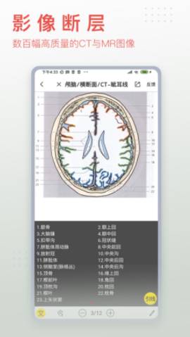 3dbody解剖app[图1]