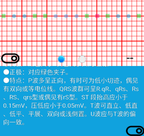 心电图计算器[图1]