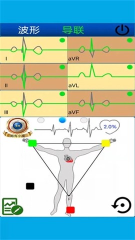 心电图计算器图2