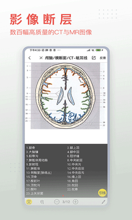 3dbody解剖app图3