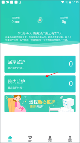 胎心监护[图1]