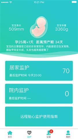 胎心监护图1