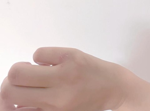 玩密室逃脱受伤怎么办