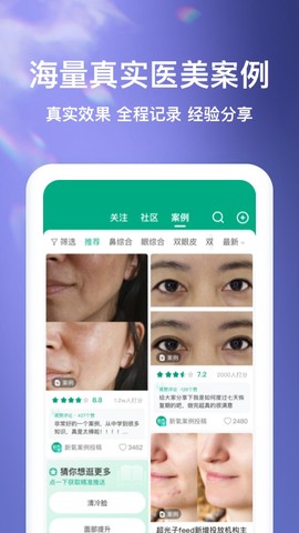 新氧极速版图2