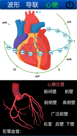 心电图计算器截图3