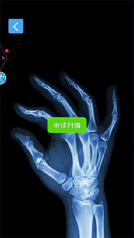 X射线模拟器截图3