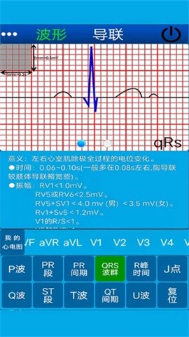 心电图计算器[图1]