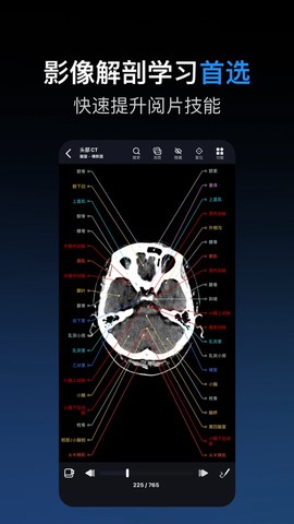 影像解剖图谱截图1