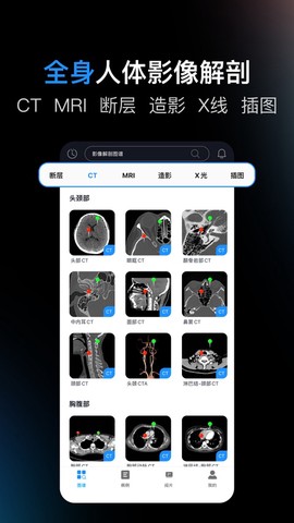 影像解剖图谱截图3