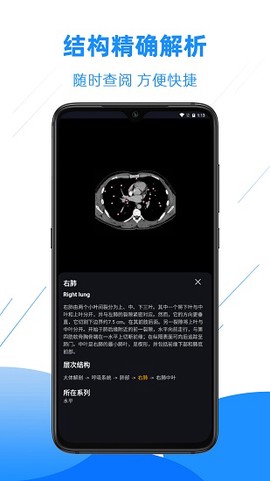 影像解剖图谱图1