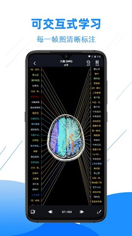 影像解剖图谱图2