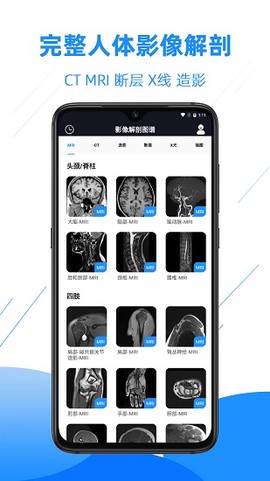 影像解剖图谱图3