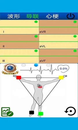 心电图计算器截图2