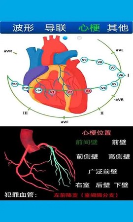 心电图计算器截图1